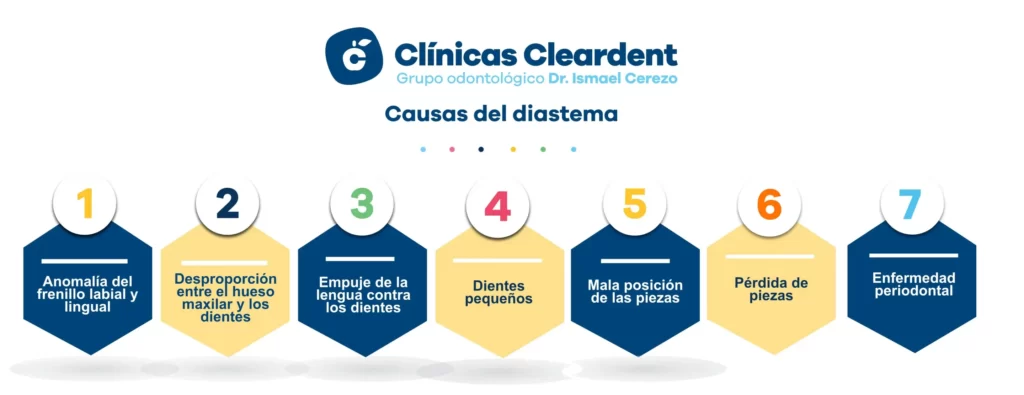 Causas del diastema Cleardent scaled 1 1024×395