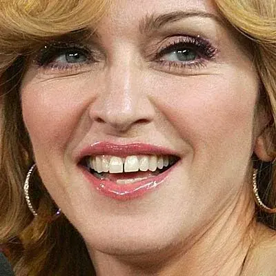 foto Madonna diastema Cleardent