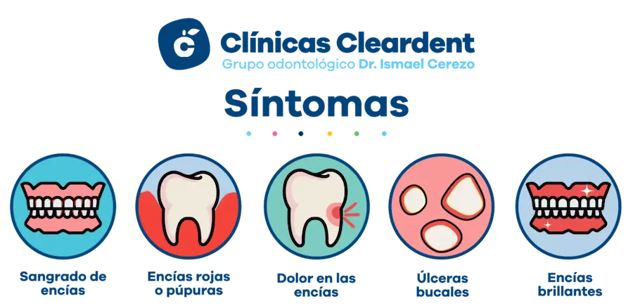 Sintomas gingivitis