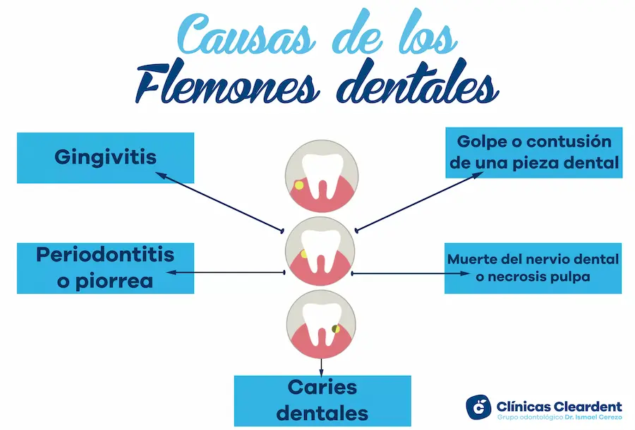 Síndrome de Disfunción Témporo-Mandibular - Cleardent