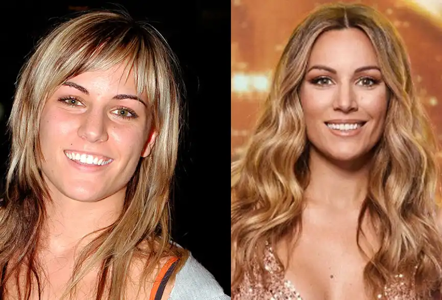 Edurne sonrisa