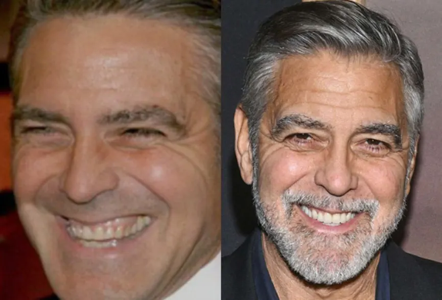 George Clooney sonrisa