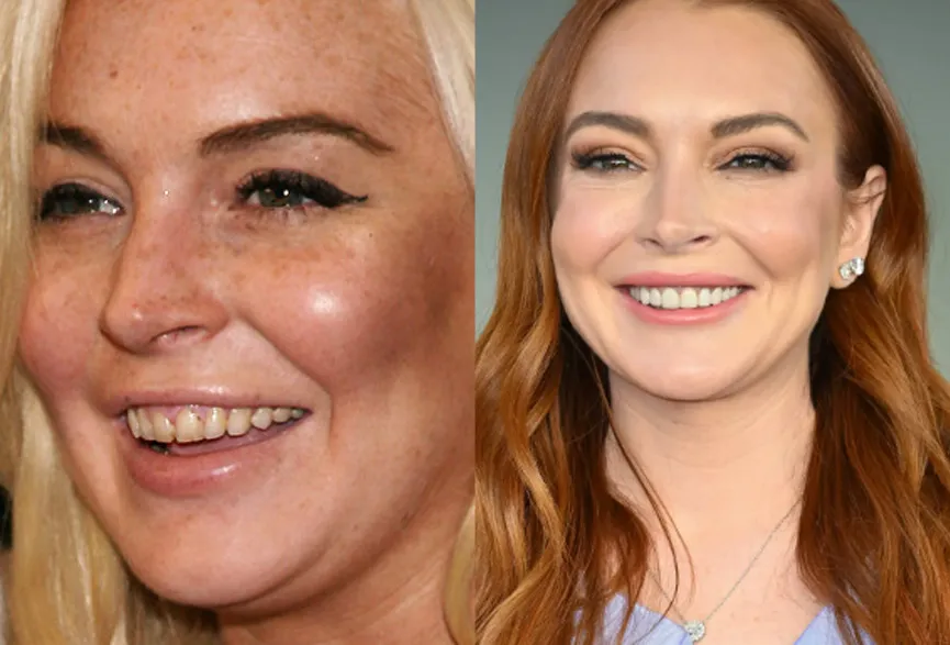 Lindsay Lohan sonrisa