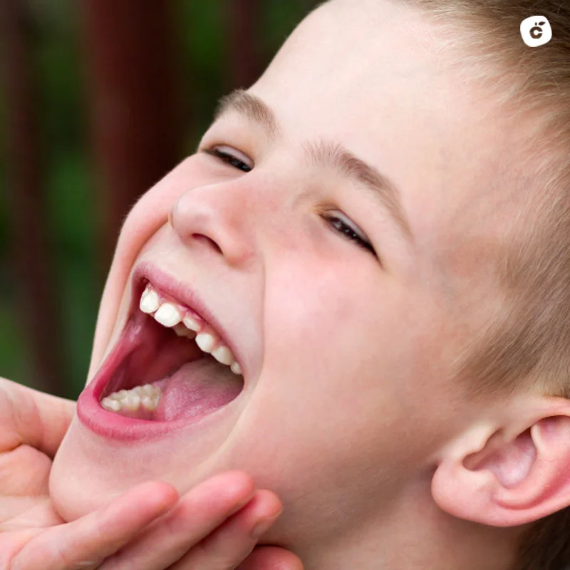 los dientes de leche