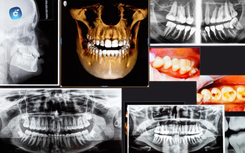 Diferencias con las radiografías tradicionales