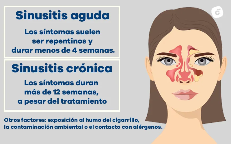 Tipos de sinusitis