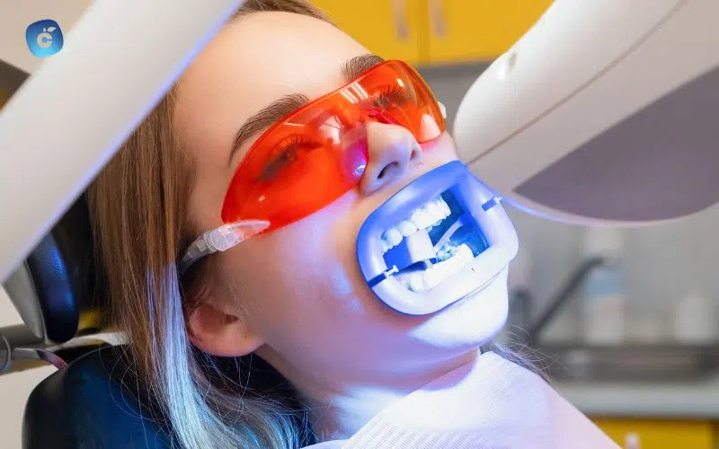 Blanqueamiento dental para una sonrisa radiante