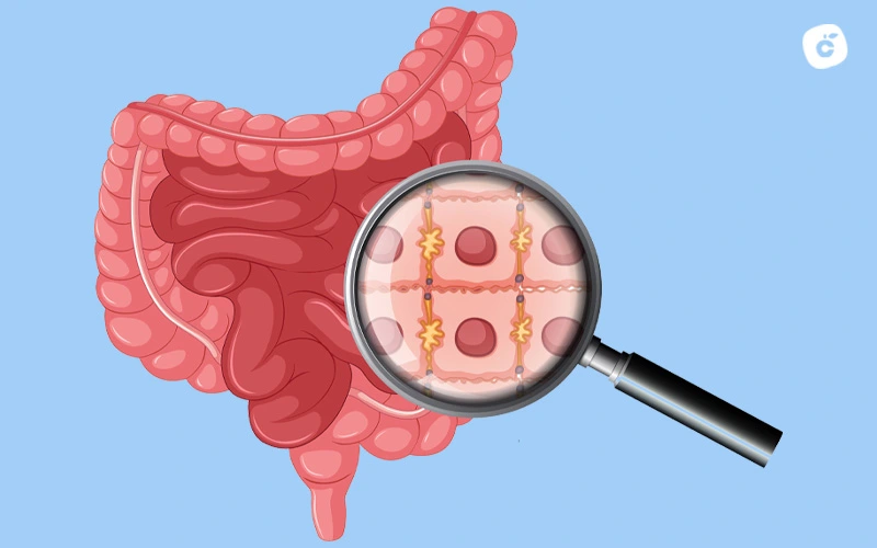 Uniones entre células intestinales