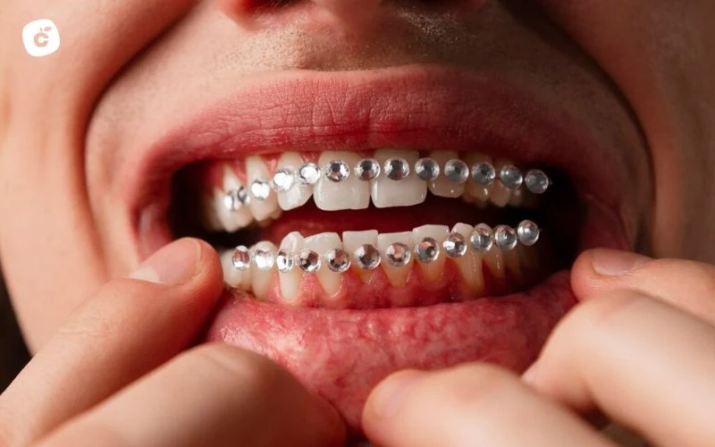 Grillz en los dientes brillantes