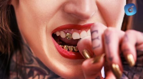 Grillz en los dientes